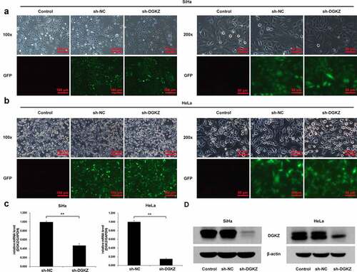 Figure 2. SiHa and HeLa cells were transfected with lentivirus plasmids (sh-NC or sh-DGKZ) to regulate DGKZ expression. (a, b) The efficient silencing of DGKZ expression in SiHa cells and HeLa cells was verified using Immunofluorescence assay. (c)The efficient silencing of DGKZ expression in SiHa and HeLa cells was verified by RT-qPCR. (d) The efficient silencing of DGKZ expression in SiHa and HeLa cells was verified by western blot analysis. (**p < 0.01)