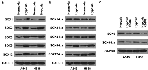 Figure 4. Hypoxia induces lactylation of SOX9. (a) The protein levels of SOX1, SOX2, SOX3, SOX9, and SOX12 in A549 and H838 cells under normoxia and hypoxia conditions. (b) The lactylation levels of SOX1, SOX2, SOX3, SOX9, and SOX12 in A549 and H838 cells under normoxia and hypoxia conditions. (c) The protein levels and lactylation levels of SOX9 in NSCLC cells treated with hypoxia and 2-DG.