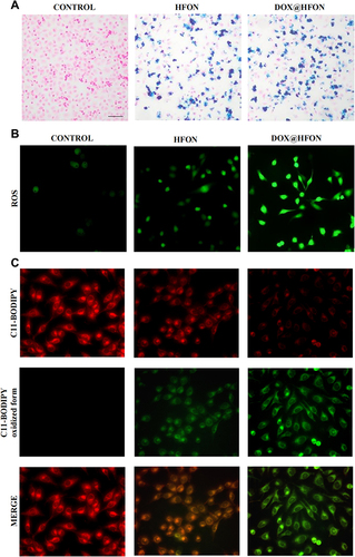 Figure 4 (A) Prussian blue staining image of cells treated with HFON and DOX@HFON; (B) ROS generate levels of MDA-MB-231 cells in vitro; (C) Fluorescence images of DOX@HFON treated cells after staining by C11-BODIPY.