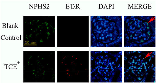 Figure 15 The location of ETAR (×400). ETAR was mainly expressed on podocytes. Red arrow: podocytes.