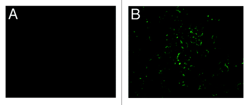 Figure 4. IFA results of infected sf9 cell to detection of pHAV-4Ang IIs. (A) pHAV-4Ang IIs in normal sf9 cells. No specific fluorescence was observed; (B) pHAV-4Ang IIs in infected sf9 cells. Specific green fluorescence was observed.