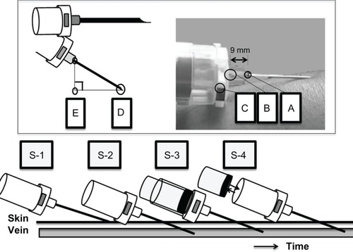 Figure 1 Location of the marker used and itemization of vacuum blood collection tube movement in the venipuncture procedure.