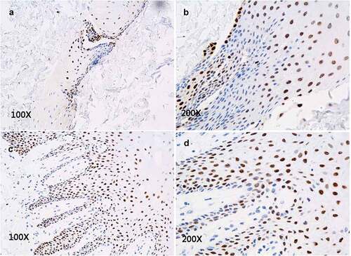 Figure 5. Immunohistochemical staining of P63 expression. P63+cells are scattered within each layer of the in vitro reconstructed tissue (A, B) and distributed in a pattern similar to that in normal oral mucosal epithelium (C, D).