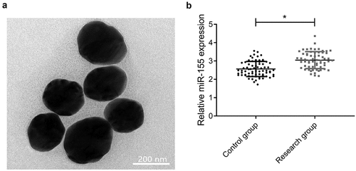 Figure 1. MiR-155 was up-regulated in serum of patients with CIS. (a) Nano-magnetic beads under TEM. (b) MiR-155 expression was detected by Nano-PCR. *P < 0.05