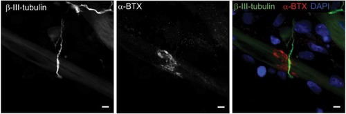 Figure 2 Characterization of neuromuscular junction formation at day 14.