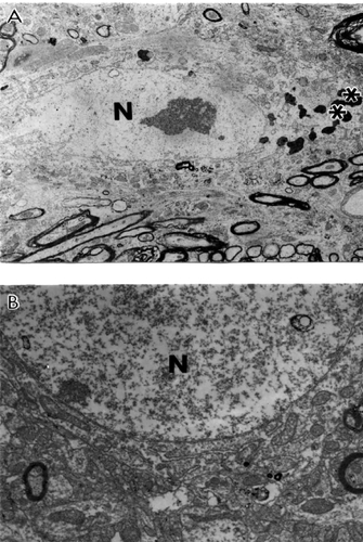 Figure 5 Age-matched control, non-transgenic mice did not show any particular changes in their neuronal ultrastructure. Lipofuscin was present in some neurons (indicate by asterisk in figure A). Original magnification of A and B: ×5,000, and ×20,000, respectively.