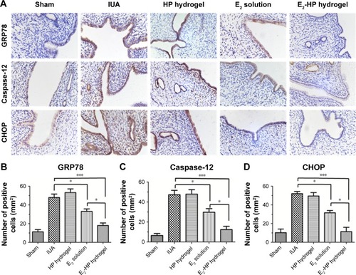 Figure 9 E2-HP hydrogel inhibits ER stress-induced apoptosis in IUA rats.Notes: (A) Immunohistochemistry for GRP78, caspase-12, and CHOP (400×) on the 14th day after different treatments with IUA; (B) Quantitative analysis of GRP78-positive cells of the immunohistochemistry results. (C) Quantitative analysis of caspase-12-positive cells of the immunohistochemistry results. (D) Quantitative analysis of CHOP-positive cells of the immunohistochemistry results. Data are presented as mean ± standard deviation; n=5; *P<0.05 and ***P<0.001.Abbreviations: CHOP, C/EBP homologous protein; ER, endoplasmic reticulum; GRP78, glucose-regulated protein; IUA, Intrauterine adhesions; HP, heparin-poloxamer.