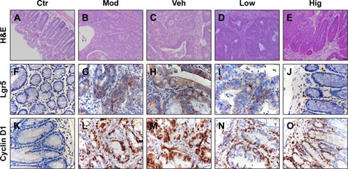 Figure 5 RTHF modulates colorectum dysplasia and Wnt/β-catenin pathway.