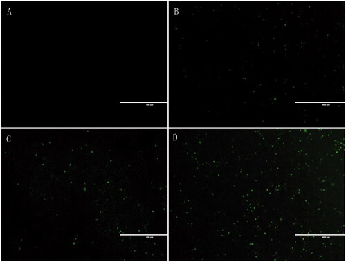 Figure 3. In vitro cellular uptake study. (A) Control; (B) free lupeol; (C) lupeol liposomes; (D) Gal-lupeol liposomes.