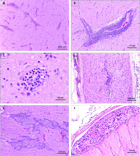 Figure 1.  Histological lesions in waterfowl infected with ABV. Haematoxylin and eosin staining. 1a: Trumpeter swan, cerebrum. Marked and extensive perivascular lymphoplasmacytic cuffing. 1b: Canada goose, cerebrum. Large perivascular lymphoplasmacytic cuff. 1c: Canada goose, cerebrum. Well-defined glial nodule. 1d: Canada goose, vagus nerve. Diffuse and perivascular lymphoplasmacytic infiltration. 1e: Canada goose, adrenal. Interstitial infiltration by lymphocytes and plasma cells primarily around chromaffin cell islets. 1f: Canada goose, proventriculus. Lymphoplasmacytic infiltration within a myenteric ganglion.