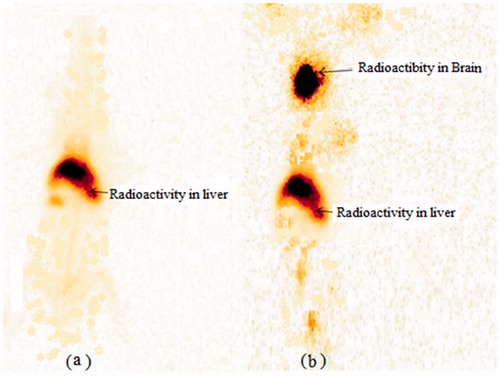 Figure 10. Gamma scintigraphy images of rabbit following i.n. administration of (a) DPL-Sol. (b) DPL-SLNs after 0.5 h.