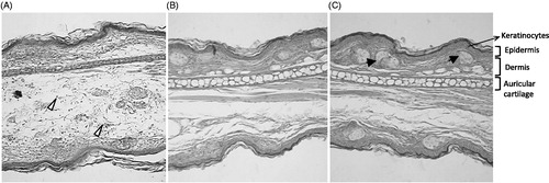 Figure 6. Representative pictures of histological slides of mouse ears treated with semisolids containing (A) placebo (Steareth21®), (B) S. trilobata dried extract (0.5%) or (C) dexamethasone (0.5%) and/or subjected to croton oil-induced ear edema (2.5%). The samples were stained with HE and photographed at 200× of augment. Sebaceous gland (black arrows) and inflammatory cells migration (white arrows).