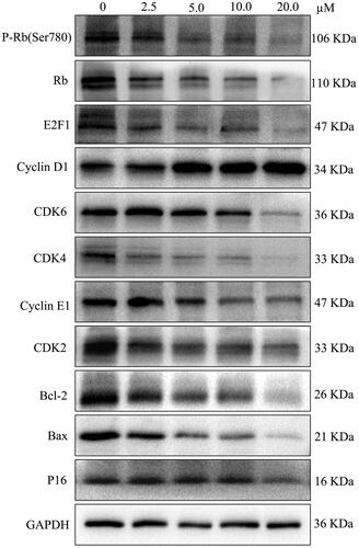 Figure 2. LEE011 suppressed cell proliferation and promoted apoptosis by inhibiting the CDK4/6-cyclin D-Rb-E2F pathway in MDA-MB-231. CDK4, CDK6, cyclin D1 levels were detected by Western blotting after treatment with LEE011 for 72 hours and the expression of proteins which connected to CDK4/6-cyclin D-Rb-E2F axis, as well as apoptosis, was simultaneously assessed.