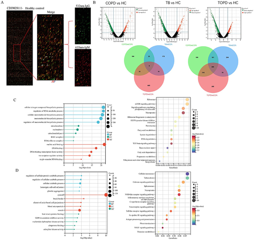 Figure 1 Distribution characteristics of IgG autoantibodies in peripheral blood of TOPD patients. (A) Show the chip results for the HC group of samples. The image on the left is the global scan of the chip, and the right is the enlarged image of the local chip (Block10). Among them, the green and red channels are 532 nm-IgG and 635 nm-IgM channels, respectively, which are merged into the composite diagram. The red arrow is the positive control point (human IgM, human IgG), and the blue arrow is the negative control point (Biotin-BSA). Yellow arrows are positive points.(B) Volcano and Venn diagram results. (C) up-regulated IgG autoantibody GO and KEGG results. (D) down-regulated IgG autoantibody GO and KEGG results.