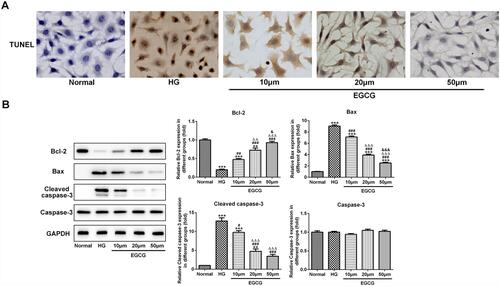 Figure 4 EGCG alleviates the apoptosis of hyperglycemia-induced vascular endothelial cells. (A) The apoptosis of HG-treated HUVECs affected by EGCG was analyzed by TUNEL assay. (B) The expression of bcl2, bax, cleaved-caspase3 and caspase3 in HG-treated HUVECs affected by EGCG was detected by Western blot analysis. **P<0.01 and ***P<0.001 vs Normal group. #P<0.05, ##P<0.01 and ###P<0.001 vs HG group. ∆∆P<0.01 and ∆∆∆P<0.001 vs EGCG10μM group. &P<0.05 and &&&P<0.001 vs EGCG20μM group.