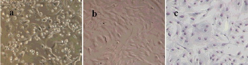 Figure 1. Morphological appearance of MSCs (×10): primary culture for 24 h (a); third generation of MSCs (b) with most cells exhibiting spindle-shaped morphology; MSCs stained with Diff-Quick solution (c).