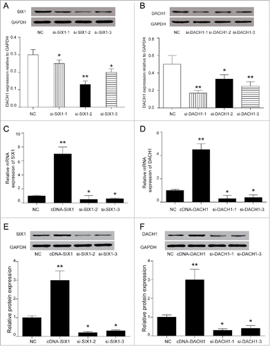 Figure 2. SiRNAs could significantly inhibit SIX1 and DACH1 expressions. (A-B) WB results showed that si-SIX1-2 had the best inhibition efficiency of SIX1 expression and si-DACH1-1 had the best inhibition efficiency. (C&E) QPCR and WB verified high expression of SIX1 in cDNA-SIX1 group and low expression of SIX1 in si-SIX1−2 group and si-SIX1-3 group. (D&F) QPCR and WB verified high expression of DACH1 in cDNA-DACH1 group and low expression of DACH1 in si-DACH1−1 and si-DACH1-3 group.