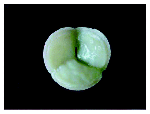Figure 2. Gross appearance of a tissue-engineered heart valve seeded with amniotic fluid-derived stem cells. Reprinted with permission.Citation42