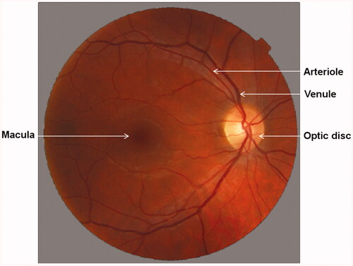 Figure 6. Fundus image of the retina (right eye; by J.P. and P.B.).