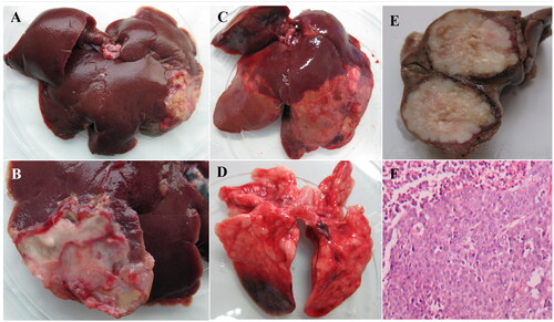 Figure 8. (A and B) are gross liver specimens of rabbit treated with large-size MVLs (group B), showing the extent of yellow-white infarcts (A) and the backside of liver embolism (B); (C and D) are gross liver specimens of rabbit treated with small-size MVLs (group A), showing yellow-white infarcts with large infarcts distributed at the edge of the liver lobe (C) and small embolic foci in the lungs (D).