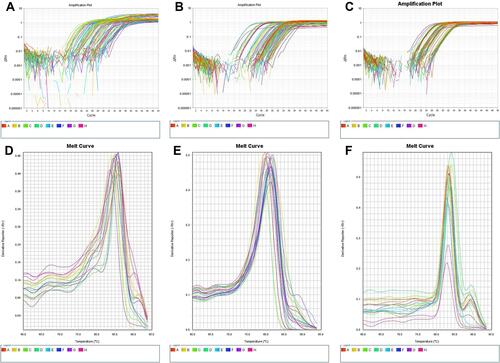 Figure 1 (A) Relative quantification of gene expression of CircANXA2 (B) relative quantification of gene expression of Circ0075001. (C) Relative quantification of gene expression of CircFBXW7. (D) Melting curve analysis for CircANXA2 expression. (E) Melting curve analysis for Circ0075001 expression. (F) Melting curve analysis for CircFBXW7 expression.
