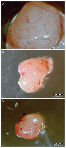 Figure 4 Images of a glioblastoma multiforme tumor cultured on chorioallantoic membrane: (A) control group, (B) ultradispersed detonation diamond group, and (C) microwave-radiofrequency group.Note: Scale bar: 1000 μm.