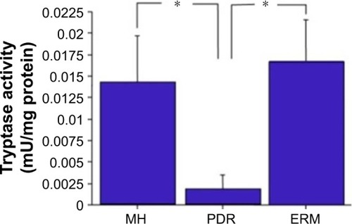 Figure 4 Tryptase activity in the vitreous. Tryptase activity in the vitreous was significantly higher in patients with ERM (n=14) and MH (n=14) compared to PDR (n=13); *P<0.05.