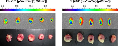 Figure 3 Fluorescent images and TTC staining photos of left ventricular transverse slices of rats.Notes: Representative fluorescent images (up) and the corresponding TTC staining photos (down) of left ventricular transverse slices taken from IR rats that received FP40k-R (left) or L-Lp loaded with FR (right) and were sacrificed at 12 hours postdose.Abbreviations: TTC, triphenyltetrazolium chloride; IR, ischemia/reperfusion; FP40k-R, FITC-labeled 40-kDa PEG mono-modified ROP; L-Lp, long-circulating liposomes; FR, FITC-labeled ROP; FITC, fluorescein isothiocyanate; PEG, polyethylene glycol; ROP, Radix Ophiopogonis polysaccharide.