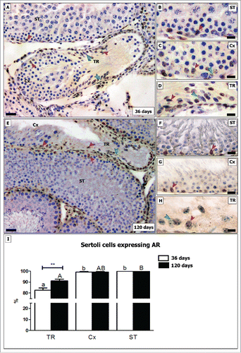 Figure 6. Evaluation of AR immunostaining in different testicular areas of pre-pubertal (A-D) and adult (E-H) Wistar rats. Images showing the seminiferous tubules (ST; B and F), the area adjacent to the transition region (Cx; C and G) and the transition region (TR; D and H). Positive and negative Sertoli cells are indicated respectively by red and green arrowheads. In TR, approximately 17% of Sertoli cells do not express AR in pre-pubertal rats. In adults, the percentage of AR negative Sertoli cells are reduced by half (8%; p < 0.05) (I). In the Cx (B, G), few AR negative Sertoli cells were observed in both young and adult rats (less than 1%). Bar: 50 μm (A and E); 10 μm (B-D, F-H). Different small and capital letters represent statistically significant differences between regions (TR, ST or Cx) respectively for young and adult rats (p < 0.05). Considering the same region, statistically significant differences (p < 0.05) were observed only for TR.