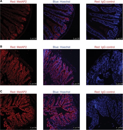 Figure 9 The MetAP2 expression in intestinal epithelial cells in lean mice.