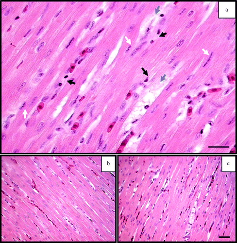 Figure 2.  2a: Generic histo-pathological features of the mural left ventricular myocardium in a broiler indicative of a subclinical heart condition. Representative micrographs showing the extent of the lesions in (2b) broilers from the group fed the placebo diet and (2c) broilers fed the diet spiked with MM extract. Bars: 2a = 25 µm, 2b and 2c = 50 µm. In broilers with a subclinical heart condition (2a), typical lesions in the ventricular myocardium consisted of degenerative changes in the cardiomyocytes characterized by distinct dull darker pink appearance of affected cardiomyocytes with cytoplasmic eosinophilia and signs of chromatine condensation (white arrows). More advanced stages were evidenced by nuclear pyknosis and karyorrhexis (black arrows). Some cardiomyocytes showed vacuolated cytoplasm and degenerative changes in nuclei indicative of advanced changes (blue arrows). The lesions appear to have similar qualitative features in both groups, but in comparison with birds from the placebo group (2b), those fed the diet containing MM extract (2c) showed more extensive degenerative changes in the ventricular myocardium.
