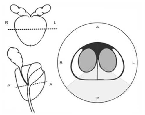 Figure 1 Schematic representation of the prostate.