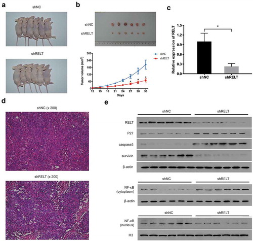 Figure 6. RELT knock-down inhibits tumor growth of ESCC in the xenograft tumor model. (a) Representative images of tumors after 33 days of implantation. (b) Tumor volume significantly decreased after 33 days of implantation in the shRELT group. (c) qRT-PCR performed to evaluate the levels of p27, caspase 3, survivin, the cytosolic NF-κB, and the nuclear NF-κB in two groups of mice. (d) Representative images of HE staining of xenograft tumors. (e) Western blotting was performed to evaluate the levels of p27, caspase 3, survivin, the cytosolic NF-κB, and the nuclear NF-κB in two groups of mice