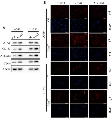 Figure 7 A1AT overexpression promotes stemness in NSCLC. (A, B) Analysis of CD133, ALCAM and CD44 expression by Western blotting (A) and immunofluorescence (B) in A1AT-overexpressing or control (Ctl) A549 and H1650 cells (scale bar, 50 μm).