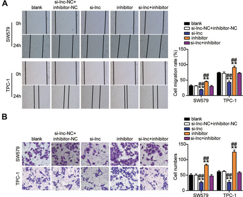 Figure 6 TNRC6C-AS1 accelerated migration and invasion of THCA cells through a miR-513c-5p-dependent way. (A) Migration of SW579 and TPC-1 cells with si-lnc or miR-513c-5p inhibitor transfection were detected by wound healing assay. (B) Invasion of SW579 and TPC-1 cells with si-lnc or miR-513c-5p inhibitor transfection were detected by transwell assay. si-lnc, Silencing TNRC6C-AS1. **P < 0.001 vs blank; ## P < 0.001 vs si-lnc+inhibitor.