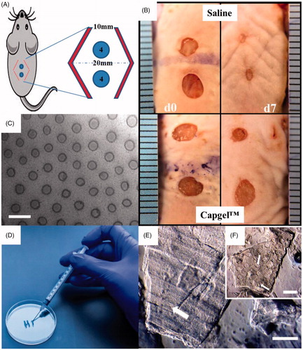 Figure 1. Overview of wound model generation and treatment methods. (A&B) Mice had 4 mm wounds created with a biopsy punch and a bipedical flap (red chevrons) was created to mimic ischemia. Mice received either saline or were treated with Capgel™. (C) Phase micrograph showing the microcapillary structure of Capgel™. (D) Capgel™ flowed in a controllable fashion from a syringe and (E&F) retained open capillaries (arrows) as entangled microparticles. Scale Bar = 200 µm.