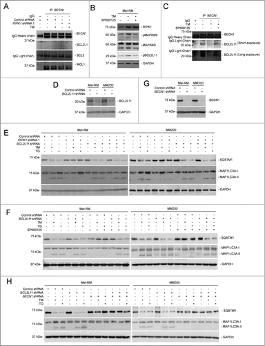 Figure 6 (See previous page). MAPK8/9 activation phosphorylates BCL2L11 and dissociates it from BECN1 in melanoma cells undergoing ER stress. (A) Whole cell lysates from Mel-RM cells transduced with control or RIPK1 shRNA 1 cells treated with tunicamycin (TM) (3 μM) for 16 h were immunoprecipitated by BECN1 antibody. The resulting precipitates were subjected to western blot analysis of BECN1, BCL2L1, BCL2, and MCL1. The data shown are representative of 3 individual experiments. (B) Whole cell lysates from Mel-RM cells treated with TM (3 μM) for 16 h with or without pretreatment with the MAPK8/9 inhibitor SP600125 (10 μM) for 1 h were subjected to western blot analysis of RIPK1, pMAPK8/9, MAPK8/9, pBCL2L11 (using a phosphorylated BCL2L11-specific antibody), and GAPDH (as a loading control). The data shown are representative of 3 individual experiments. (C) Whole cell lysates from Mel-RM cells treated with TM (3 μM) for 16 h with or without pretreatment with the MAPK8/9 inhibitor SP600125 (10 μM) for 1 h were subjected to immunoprecipitation with an antibody against BECN1. The resulting precipitates were subjected to western blot analysis of BECN1 and BCL2L11. The data shown are representative of 3 individual experiments. (D) Whole cell lysates from Mel-RM and MM200 cells transduced with the control or BCL2L11 shRNA were subjected to western blot analysis of BCL2L11 and GAPDH (as a loading control). The data shown are representative of 3 individual experiments. (E) Mel-RM and MM200 cells stably transduced with the control or BCL2L11 shRNA were transduced with RIPK1 shRNA 1 and treated with TM (3 μM) or thapsigargin (TG) (1 μM) for 16 h. Whole cell lysates were subjected to western blot analysis of SQSTM1, MAP1LC3A, or GAPDH (as a loading control). The data shown are representative of 3 individual experiments. (F) Mel-RM and MM200 cells stably transduced with the control or BCL2L11 shRNA were treated with TM (3 μM) or TG (1 μM) for 16 h with or without pretreatment with the MAPK8/9 inhibitor SP600125 (10 μM) for 1 h were subjected to western blot analysis of SQSTM1, MAP1LC3A, or GAPDH (as a loading control). The data shown are representative of 3 individual experiments. (G) Mel-RM and MM200 cells with BCL2L11 stably knocked down were transduced with the control or BECN1 shRNA. Twenty-four h later, whole cell lysates were subjected to western blot analysis of BECN1 or GAPDH (as a loading control). The data shown are representative of 3 individual experiments. (H) Mel-RM and MM200 cells with or without BCL2L11 and BECN1 co-knocked down were treated with TM (3 μM) or TG (1 μM) for 16 h. Whole cell lysates were subjected to western blot analysis of SQSTM1, MAP1LC3A, and GAPDH (as a loading control). The data shown are representative of 3 individual experiments.