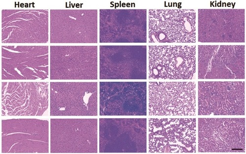 Figure 6 Histopathological studies of heart, liver, spleen, lung and kidney among four groups. (From top to bottom was control, free CUR, CPN and CPTN, respectively).