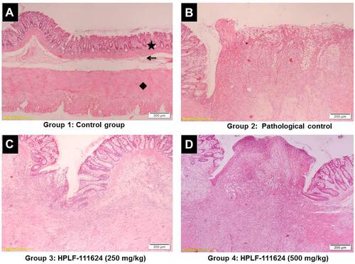 Figure 10 Representative photomicrographs showed the effect of HPLF-111624 treatment on the histopathological changes of the rectal tissue in the anal fissure.