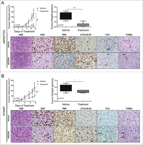 Figure 3. AZD2281 significantly inhibits MPNST local tumor growth in vivo. (A) Seventeen female hairless SCID mice were injected with 2 × 106 MPNST724 cells and treated with AZD2281 for 23 d. Treatment groups included vehicle (10% HPCB, 10% DMSO, and PBS) (n = 9) and 50 mg/kg/day AZD2281 (n = 8). Tumor volume and weight were assessed. Tumor samples stained for Ki67, PAR, cyclin B1, CC3, and TUNEL. (B) Mouse experiment proceeded as above excepting 16 mice (n = 8 per treatment group) were injected with STS26T cells and treated with AZD2281 for 19 d. Original photos were captured at 400× magnification. Error bars represent standard deviation; (*=p < 0.05; ***=p < 0.001).