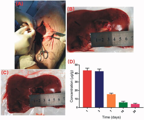Figure 5. Detection of DOX concentration in liver at the implantation site. (A) The DOX-loaded implants were implanted into the left lobe of liver. (B) The picture of the implantation site after intrahepatic implantation of the DOX-loaded implants. (C) The drug residues were removed before detecting the DOX concentration in liver tissues. (D) Concentration of DOX in liver tissues at the implantation site.