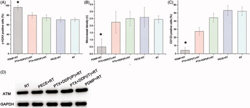 Figure 4. Quantitative analysis of γ-H2AX, CD133, and CD31 and the expression of ATM in xenografts from mice in various treatment groups. (A) quantitative analysis of γ-H2AX in mouse xenografts in various treatment groups; (B) quantitative analysis of CD133 in mouse xenografts in various treatment groups; (C) quantitative analysis of CD31 in mouse xenografts in various treatment groups; (D) expression levels of ATM in mouse xenografts in treatment various groups; PTX: paclitaxel; DDP: cisplatin; PDMP: mixing mPEG-PCL/PTX micelles with DDP-loaded PECE hydrogels; IP: intraperitoneal injection; IT: intratumoral injection.