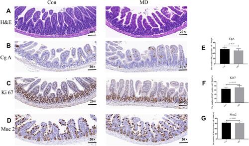 Figure 2 MD mice did not have impaired intestinal mucosa barrier function. Small intestine sections of healthy control (Con; left) and MD (right) mice were stained with hematoxylin and eosin (H&E) and observed under a microscope (magnification, ×200). Representative immunohistochemical staining of chromogranin A (H&E) (A) (CgA) (B), Ki67 (C), and Muc2 (D) in small intestine sections from MD and Con mice (magnification, ×200). Number of cells that were positive for CgA (E), Ki67 (F), and Muc2 (G) in MD and Con mice (n=10/group). Cells in ten high-power fields were counted. Data are expressed as mean ± SEM.