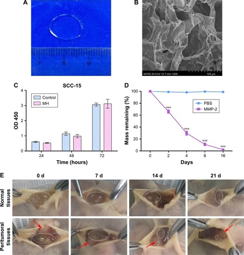 Figure 1 Characterization of MH.Notes: (A) General morphological map of MH. (B) SEM image of MH (scale bar represents 100 µm, magnification ×500). (C) Cytotoxicity test of MH (mean ± SD, n=6). (D) The degradation of MH in vitro (mean ± SD, n=3, ***P<0.001). (E) The degradation of MH in vivo (red arrows point to the tumor tissues; gels that remained are circled).Abbreviations: MH, MMP-responsive hydrogel; MMP, matrix metalloproteinase; SEM, scanning electron microscopy.