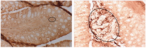 Figure 4. P-selectin expression in later-stage of ENDO and DMH exposure regimens. (A) Week 30, colon of representative section from ENDO mouse: strong staining in epithelia of individual aberrant crypts (circled). (B) Week 30, representative section from colon of DMH mouse: strong staining of pre-neoplastic formations (circled). Magnification =10×; DAB staining.