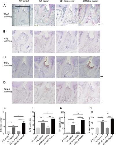 Figure 4 Histological analysis of periodontal supportive tissue. A 4×3 mm2 area (indicated by black box) including the periodontal soft and hard tissues between the first and second molars was selected as the region of interest (ROI). The number of cells positive for multinucleated TRAP along the alveolar bone surface, and for RANKL, IL-1β, or TNF-α in the ROI from each section were counted. (A–D) Representative tartrate-resistant acid phosphatase (TRAP)-, IL-1β-, TNF-α-, and RANKL-stained sections of periodontal tissues harvested from WT and CD19Cre mice with or without ligature-induced periodontitis (×100 magnification, scale bar: 500 μm). (E–H) Quantification of TRAP-, IL-1β-, TNF-α-, and RANKL-positive cells between the first and second molars. Results are represented as the number of positive cells in the ROI and shown as the mean ± standard error of the mean (n = 8 per group). *P < 0.05, **P < 0.01, ***P < 0.001, ****P < 0.0001, ns no significance (one-way ANOVA).