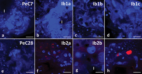 Figure 9. Midgut of Pam. experimentalis stained with TUNEL assay and DAPI, confocal microscopy. Nuclei (blue signals), DNA fragmentation (red signals). (a;e) the midgut of Pam. experimentalis in control groups, (A) bar = 10 μm, (E) bar = 10.71 μm. (b) the midgut of Pam. experimentalis treated with ibuprofen for 7 days; concentration of ibuprofen 0.1 μg/L – Ib1a, bar = 11.77 μm. (c) the midgut of Pam. experimentalis treated with ibuprofen for 7 days; concentration of ibuprofen 16.8 μg/L – Ib1b, bar = 10.53 μm. (d) the midgut of Pam. experimentalis treated with ibuprofen for 7 days; concentration of ibuprofen 1 mg/L – Ib1c, bar = 8.33 μm. (f) the midgut of Pam. experimentalis treated with ibuprofen for 28 days; concentration of ibuprofen 0.1 μg/L – Ib2a, bar = 11.11 μm. (g) the midgut of Pam. experimentalis treated with ibuprofen for 28 days; concentration of ibuprofen 16.8 μg/L – Ib2b, bar = 8.33 μm. (h) the midgut of Pam. experimentalis treated with ibuprofen for 28 days; concentration of ibuprofen 1 mg/L – Ib2c, bar = 9.10 μm.