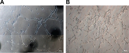 Figure 4 Comparison of the ability to form capillary-like structure between HUVECs and EPCs. A) Capillary-like structure formation in HUVECs as positive control (magnification ×100). B) Bone marrow-derived EPCs form the same capillary-like clusters (magnification ×100).Abbreviations: EPCs, endothelial progenitor cells; HUVECs, human umbilical vein endothelial cells.