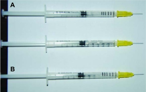 Figure 2 Syringes lacking numbered graduations used in order to maintain blinding of injecting physician.