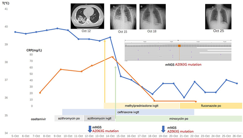 Figure 1 Timeline of the clinical course of the case and identification of A2063G mutation.